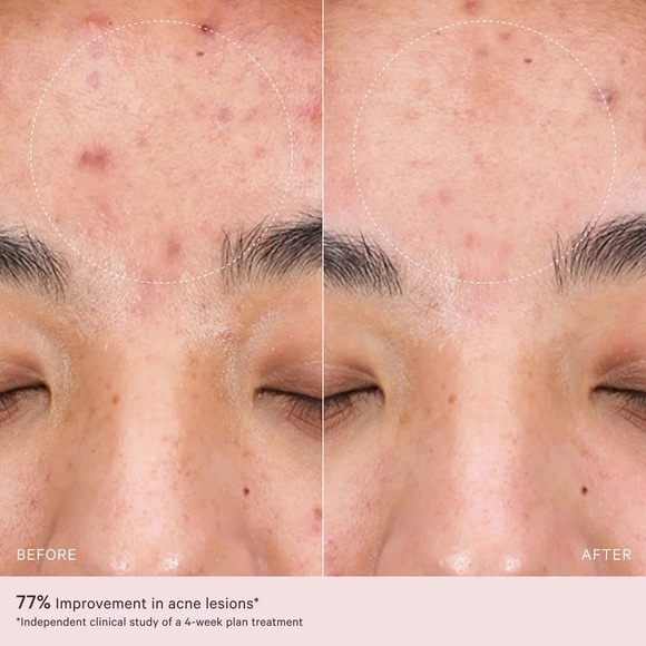 MZ Skin LED 2.0 LightMAX Supercharged LED Mask - BRAND NEW IN SEALED BOX - Picture 9 of 12